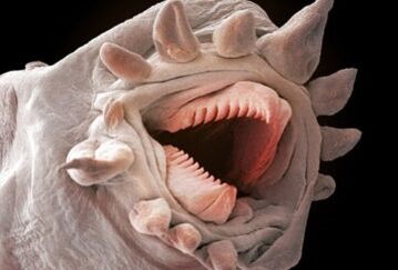 quais vermes podem viver no corpo humano