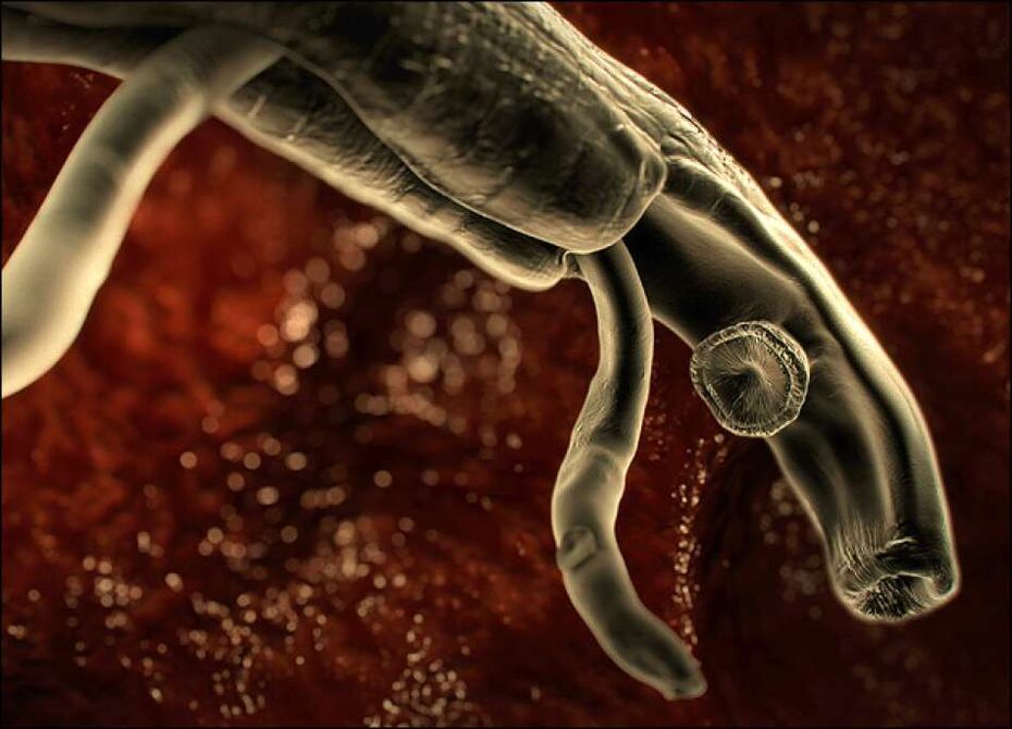 parasitas dentro do corpo humano