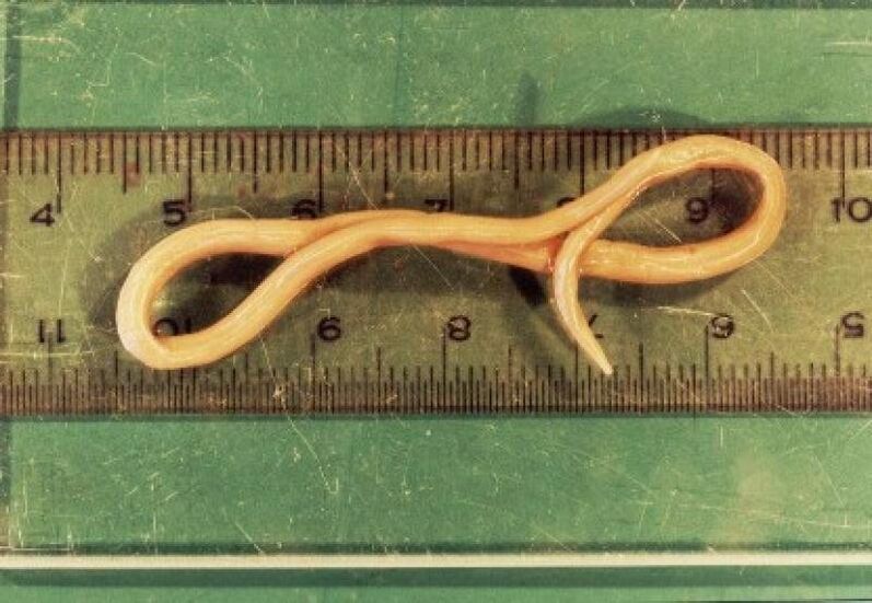 parasita de lombriga do corpo humano