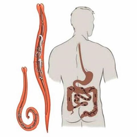 vermes no intestino humano