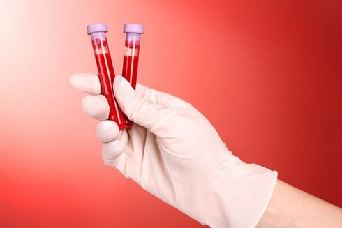 exame de sangue para parasitas