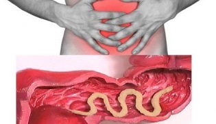 sintomas da presença de parasitas no intestino humano