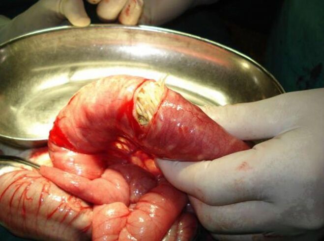 ches parasitas são perigosos para os humanos